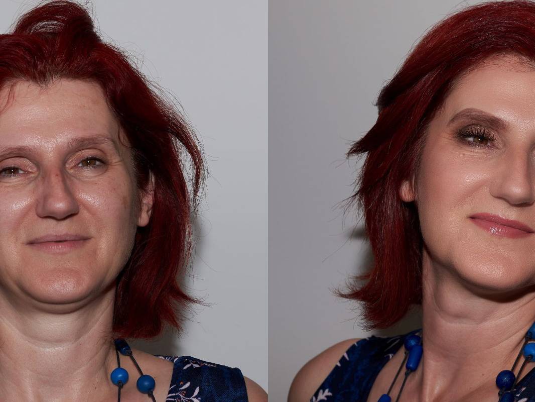 zorica prije poslije